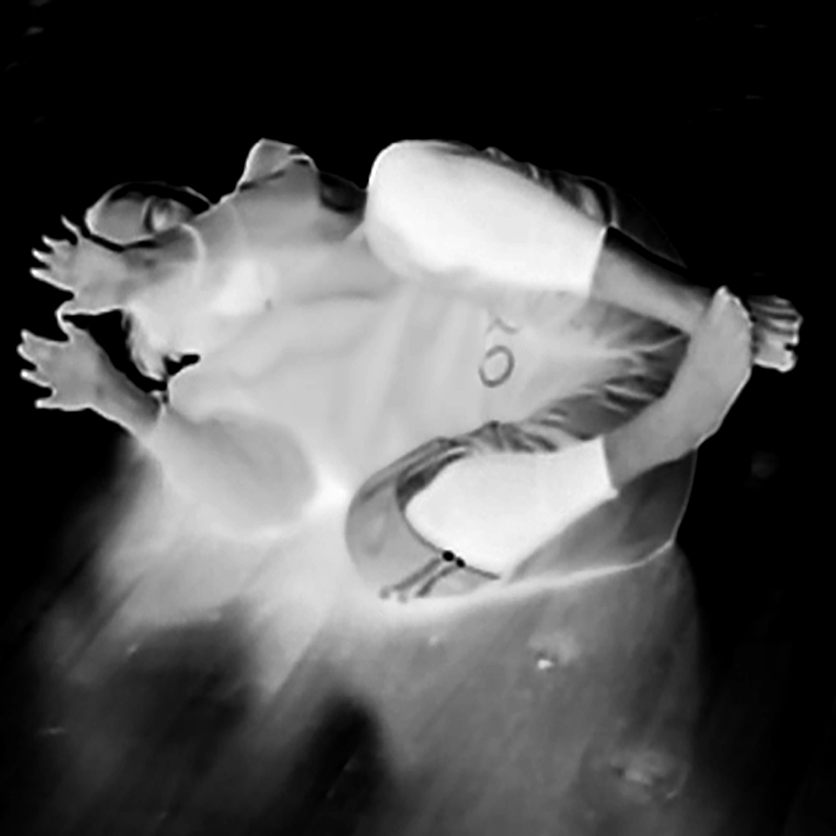 x-ray black and white image